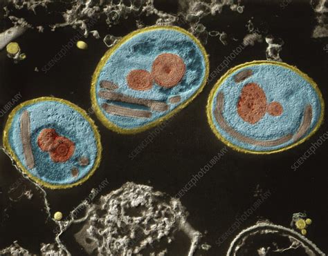 Microsporidia ¡Un mundo microscópico de parásitos con una estrategia de supervivencia excepcional!