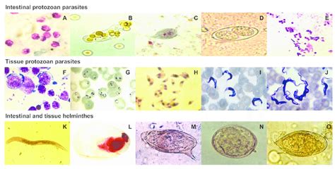 Cryptosporidium: ¿Un parásito microscópico que causa estragos en el intestino? ¡Aprende sobre este intrusivo invasor del mundo animal!